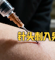 狂犬病男孩14处咬伤！救星降临创奇迹